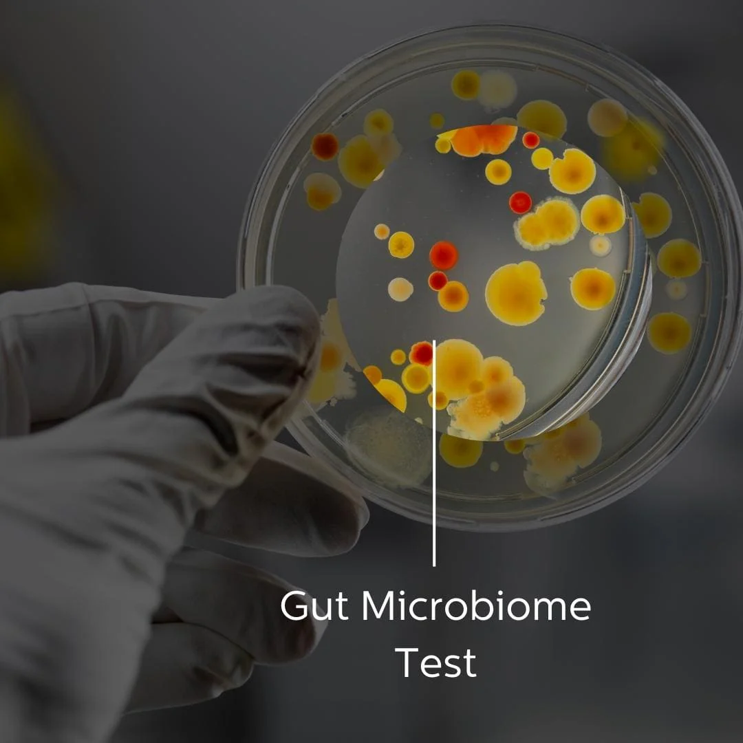 Day 2- The Evolutionary Dance of the Gut Microbiome: How Our Microbial Partners Adapt and Thrive